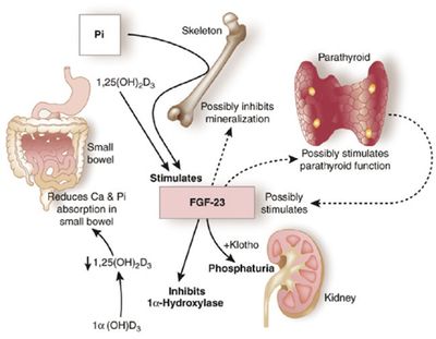  hyperphosphatemia