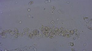 cellular red cell cast copy