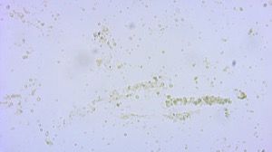 cellular red cell cast low power copy