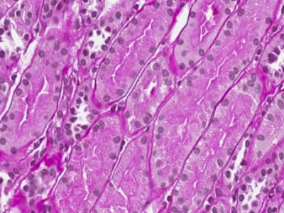 image-7-normal-tubules