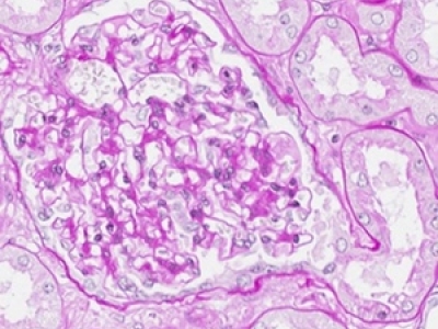 image-9-normal-glomerulus-with-tubular-and-vascular-poles